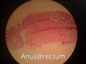 بافت آنوس و رکتوم ( Anus and rectum