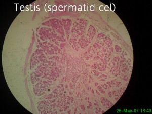 سلولهای اسپرماتید( spermatid of testis